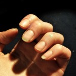 fingernails
