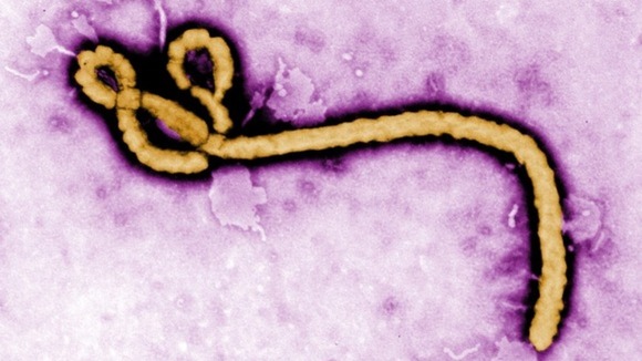 Ebola, Zombies, and Our Viral Past