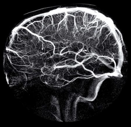 Advanced Pain Studies